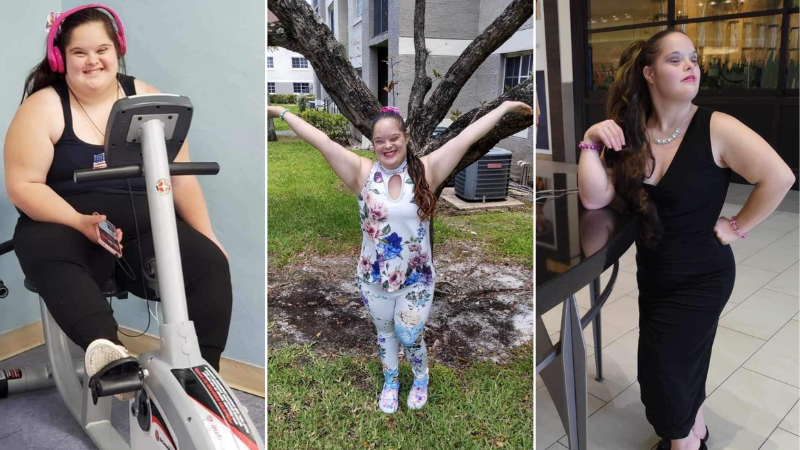 Coconut Creek Mom Advocates for Daughter with Down Syndrome, Secures Weight Loss Surgery